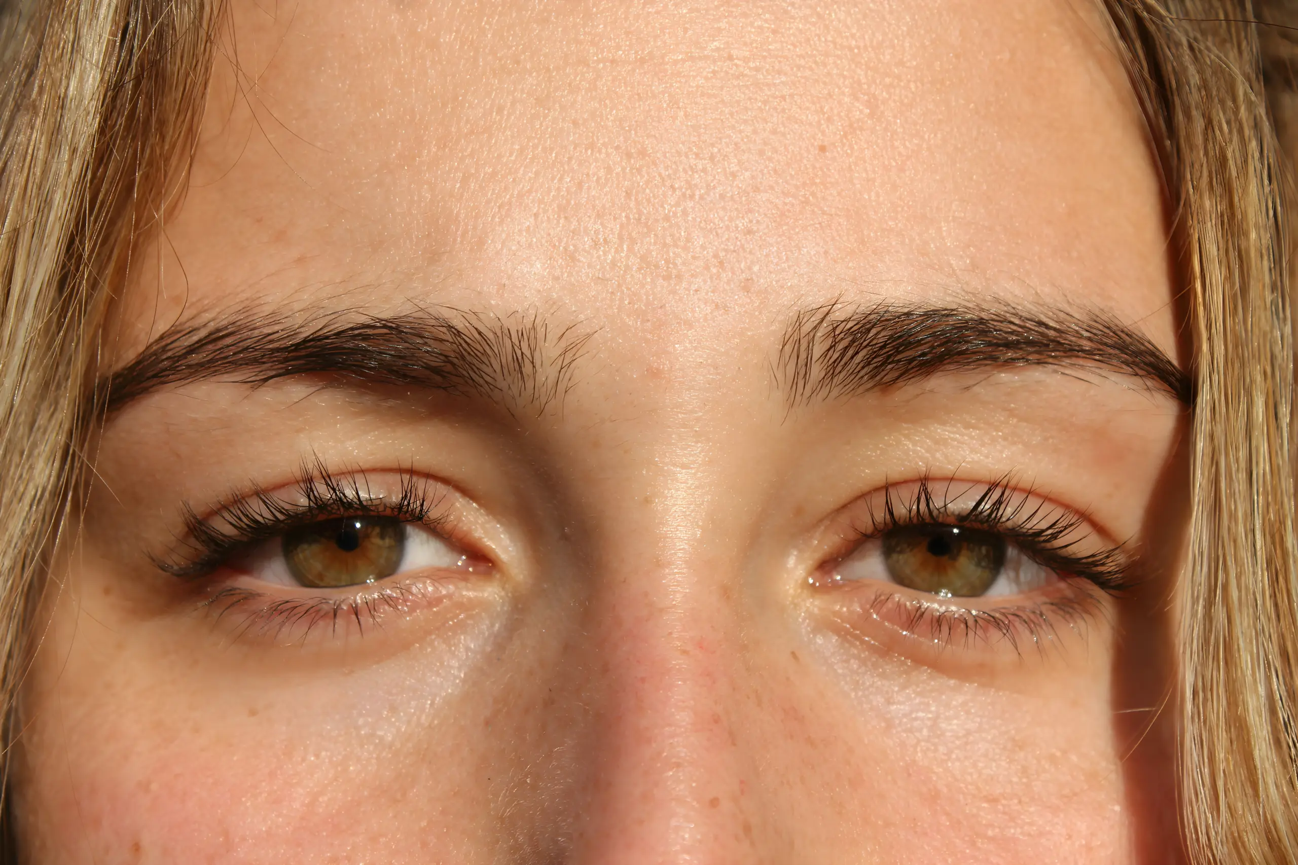 Dry Eyes Causes, Symptoms, and How to Find Relief